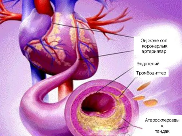 Оң және сол коронарлық артериялар Эндотелий Тромбоциттер Атеросклероздық таңдақ