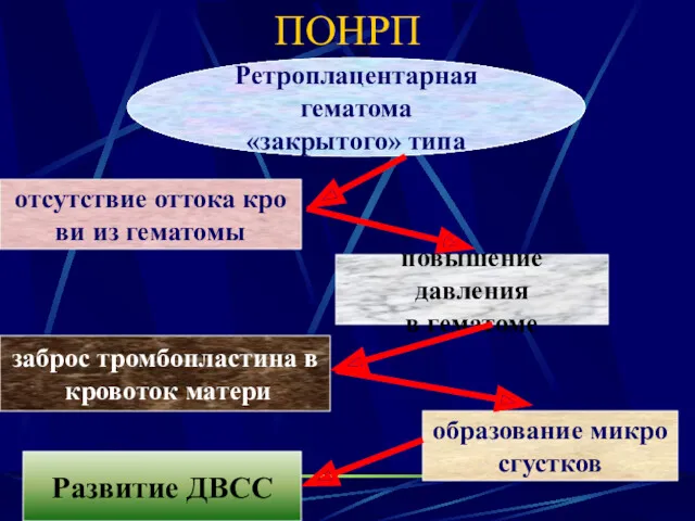 ПОНРП Ретроплацентарная гематома «закрытого» типа отсутствие оттока кро ви из