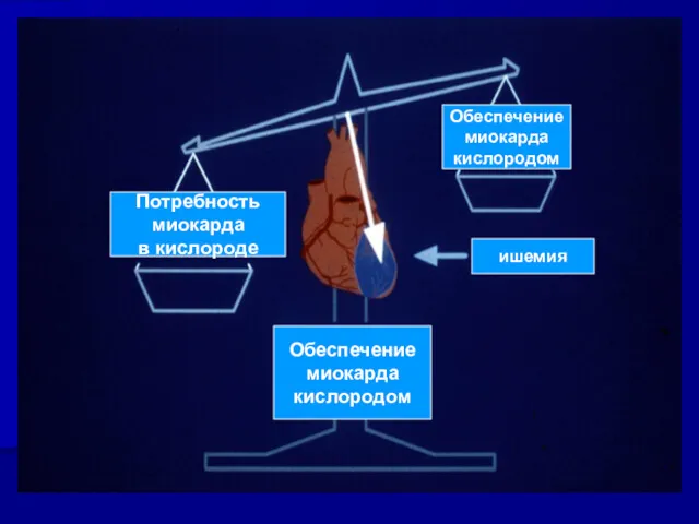 Потребность миокарда в кислороде Обеспечение миокарда кислородом ишемия Обеспечение миокарда кислородом