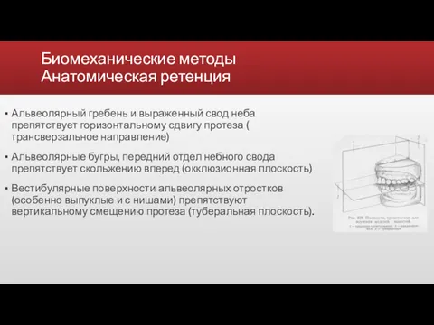 Биомеханические методы Анатомическая ретенция Альвеолярный гребень и выраженный свод неба препятствует горизонтальному сдвигу