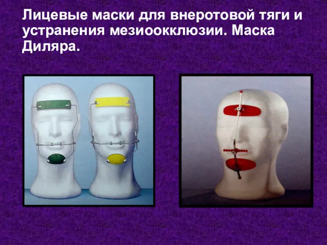 Лицевые маски для внеротовой тяги и устранения мезиоокклюзии. Маска Диляра.