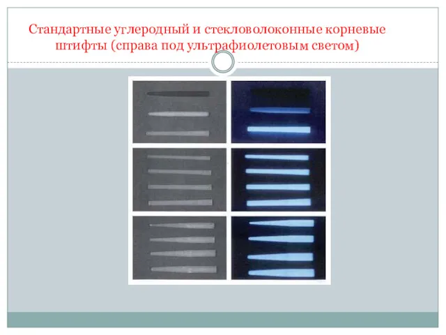 Стандартные углеродный и стекловолоконные корневые штифты (справа под ультрафиолетовым светом)