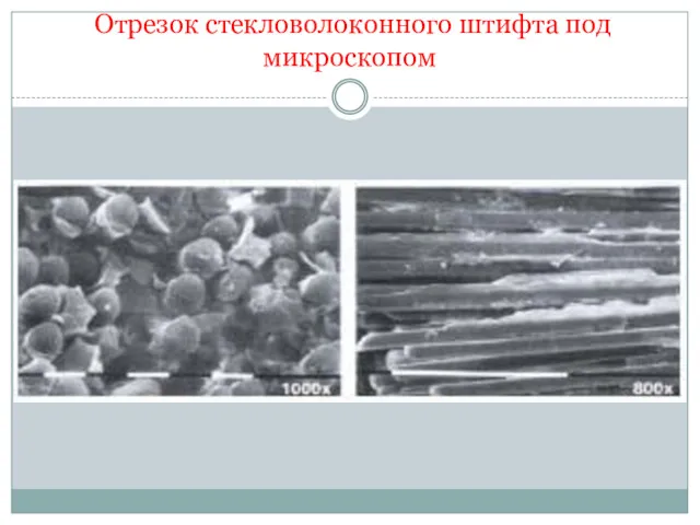 Отрезок стекловолоконного штифта под микроскопом