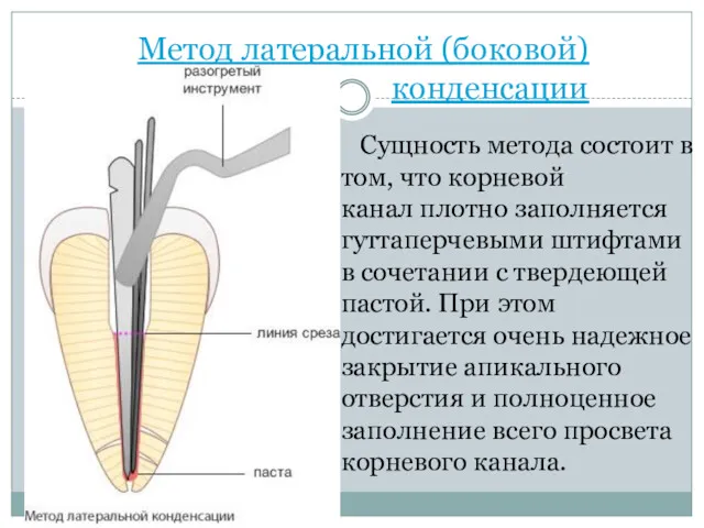 Метод латеральной (боковой) конденсации Сущность метода состоит в том, что