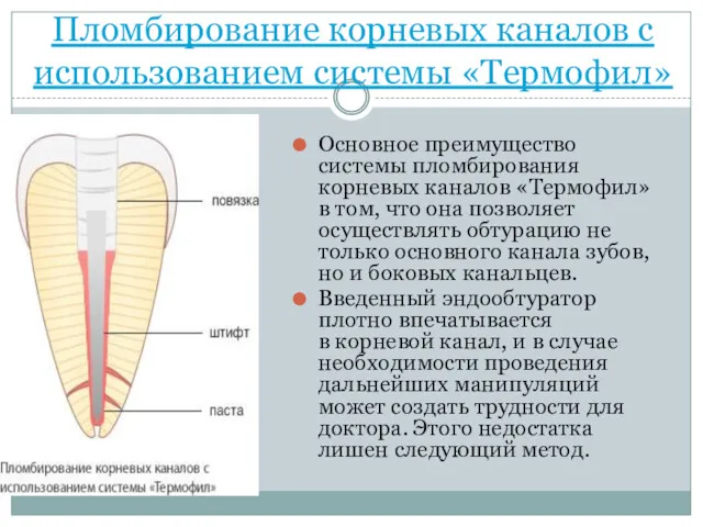 Пломбирование корневых каналов с использованием системы «Термофил» Основное преимущество системы