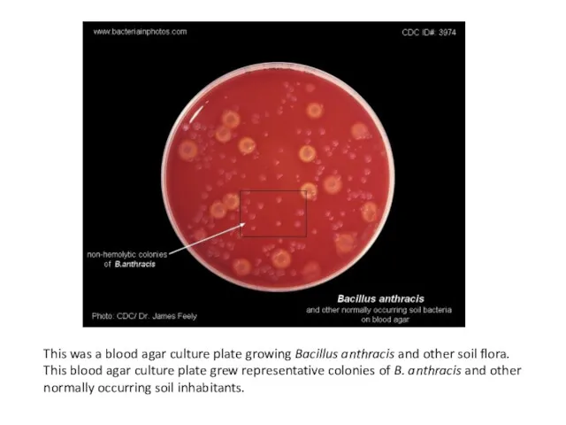 This was a blood agar culture plate growing Bacillus anthracis