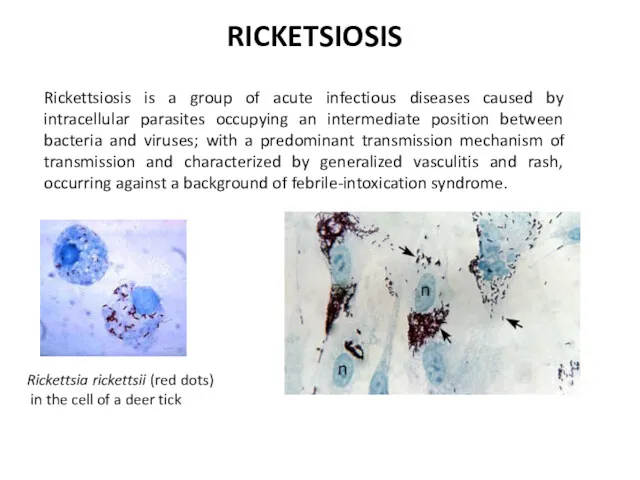 Rickettsiosis is a group of acute infectious diseases caused by