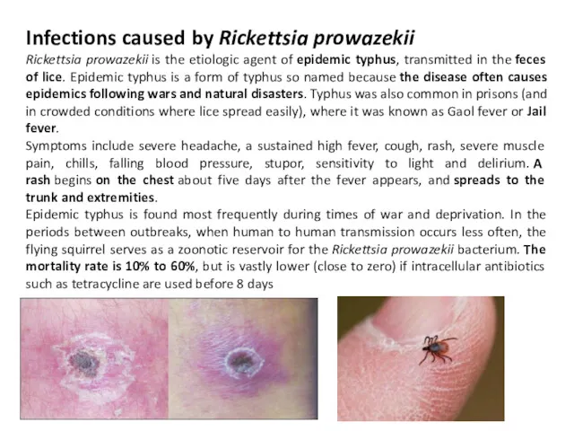 Infections caused by Rickettsia prowazekii Rickettsia prowazekii is the etiologic
