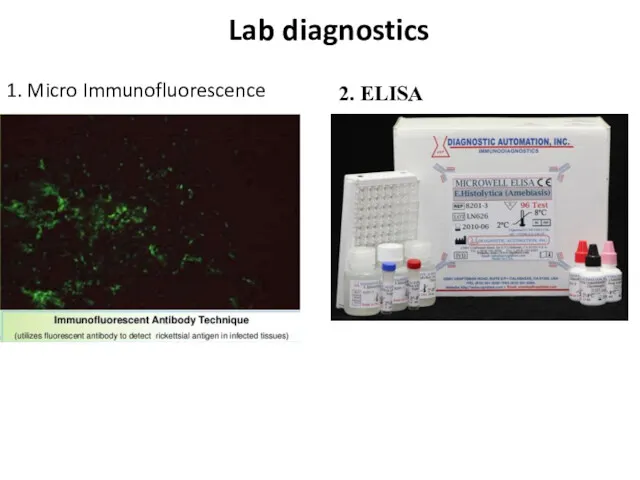 Lab diagnostics 1. Micro Immunofluorescence 2. ELISA