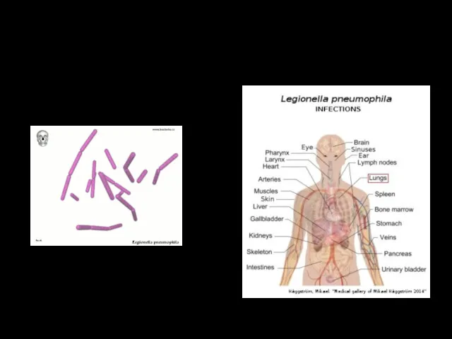 LEGIONELLOSIS Legionellosis is an infectious disease caused by legionella bacteria