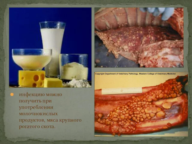 инфекцию можно получить при употреблении молочнокислых продуктов, мяса крупного рогатого скота.
