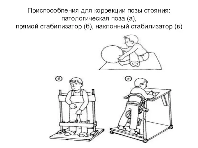 Приспособления для коррекции позы стояния: патологическая поза (а), прямой стабилизатор (б), наклонный стабилизатор (в)