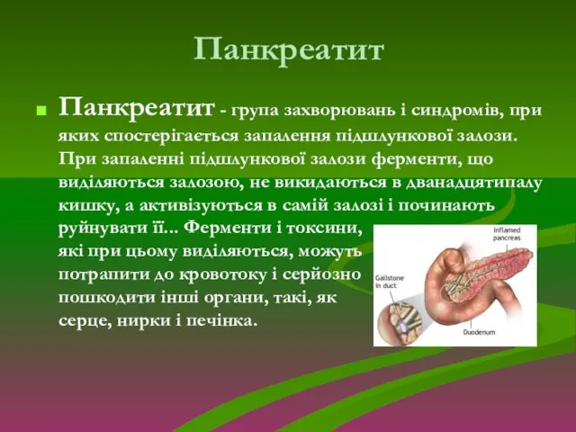 Панкреатит Панкреатит - група захворювань і синдромів, при яких спостерігається