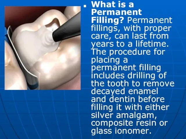 What is a Permanent Filling? Permanent fillings, with proper care, can last from