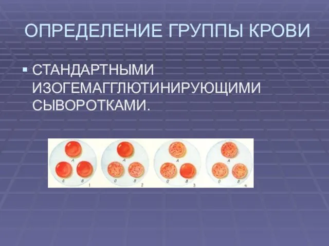 ОПРЕДЕЛЕНИЕ ГРУППЫ КРОВИ СТАНДАРТНЫМИ ИЗОГЕМАГГЛЮТИНИРУЮЩИМИ СЫВОРОТКАМИ.