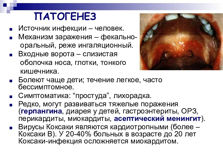 ПАТОГЕНЕЗ Источник инфекции – человек. Механизм заражения – фекально- оральный,