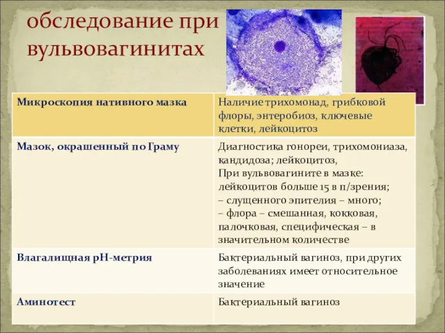 обследование при вульвовагинитах