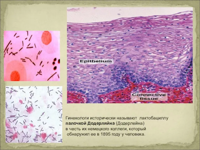 Гинекологи исторически называют лактобациллу палочкой Додерляйна (Додерлейна) в честь их