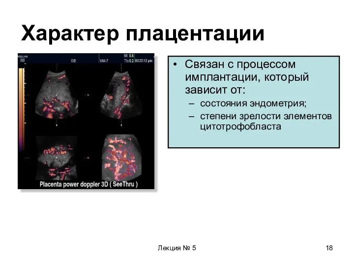 Лекция № 5 Характер плацентации Связан с процессом имплантации, который