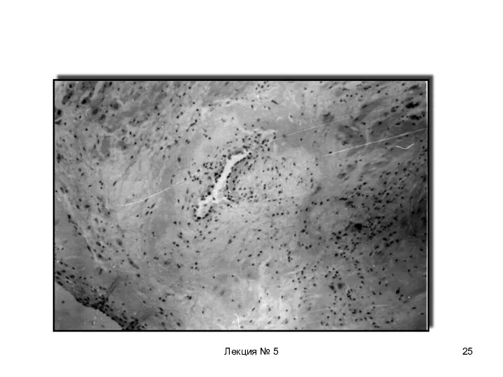 Лекция № 5