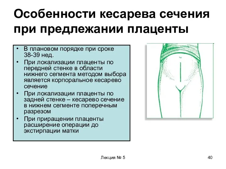 Лекция № 5 Особенности кесарева сечения при предлежании плаценты В