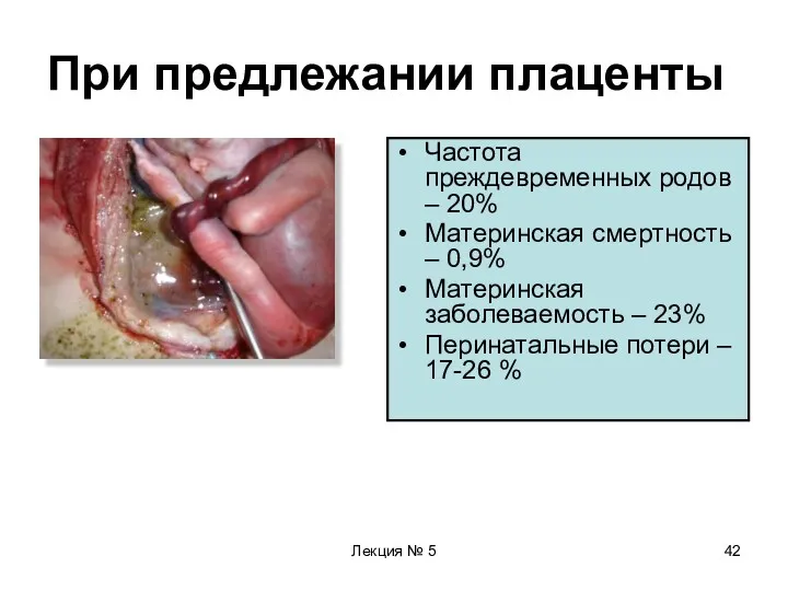 Лекция № 5 При предлежании плаценты Частота преждевременных родов –