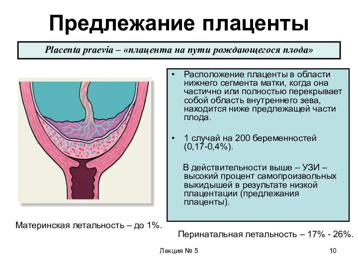 Лекция № 5 Предлежание плаценты Расположение плаценты в области нижнего