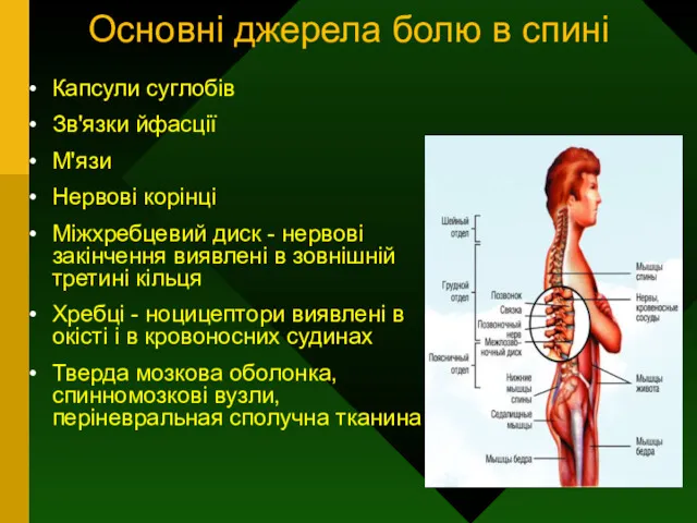 Основні джерела болю в спині Капсули суглобів Зв'язки йфасції М'язи Нервові корінці Міжхребцевий