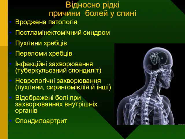 Відносно рідкі причини болей у спині Вроджена патологія Постламінектомічний синдром Пухлини хребців Переломи