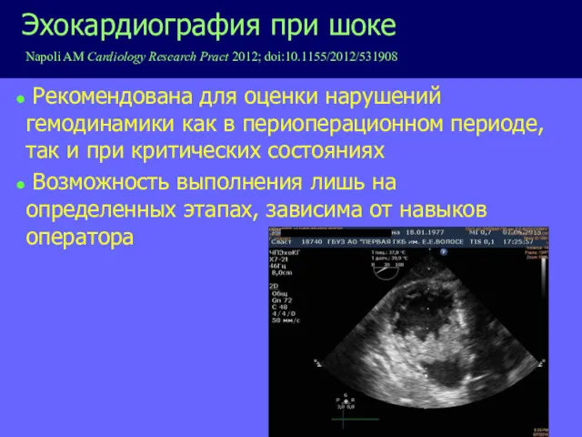 Рекомендована для оценки нарушений гемодинамики как в периоперационном периоде, так