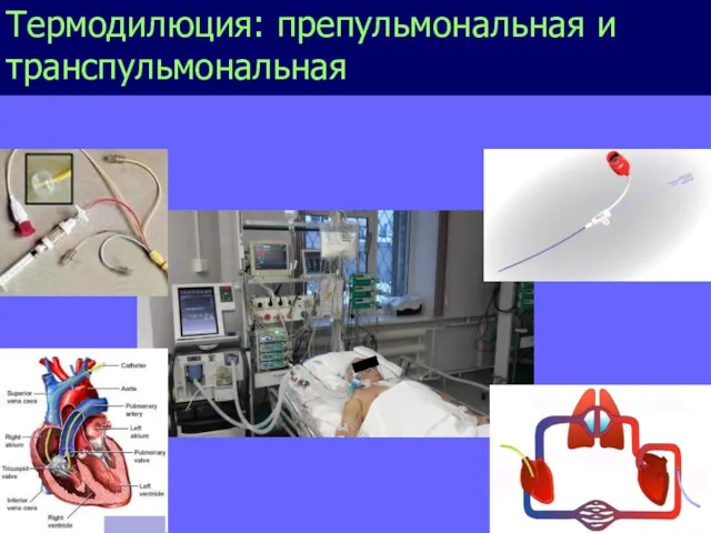 Термодилюция: препульмональная и транспульмональная