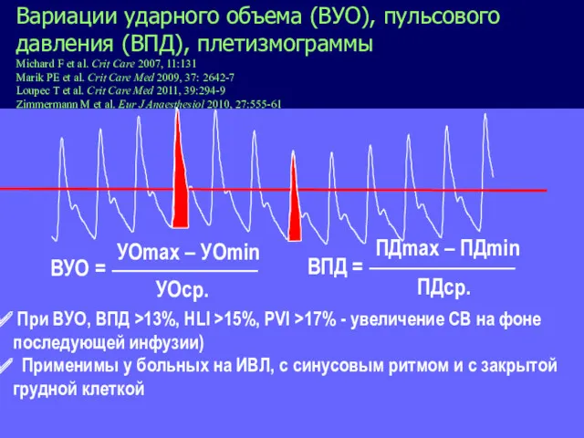 Вариации ударного объема (ВУО), пульсового давления (ВПД), плетизмограммы Michard F