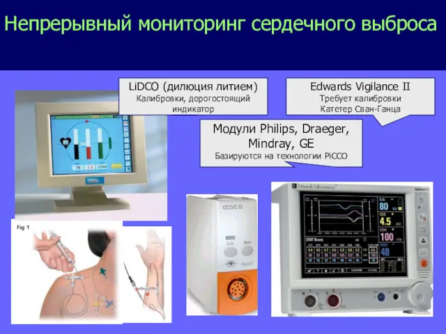 LiDCO (дилюция литием) Калибровки, дорогостоящий индикатор Edwards Vigilance II Требует