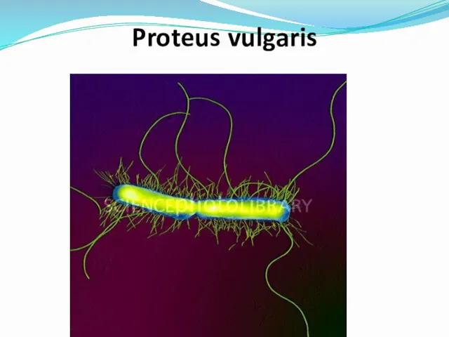 Proteus vulgaris