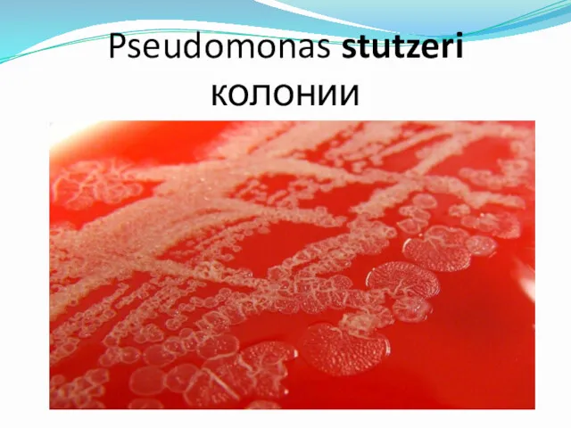 Pseudomonas stutzeri колонии