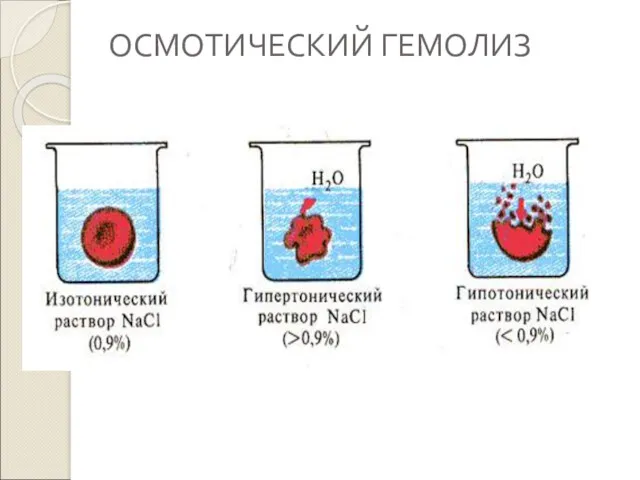 ОСМОТИЧЕСКИЙ ГЕМОЛИЗ