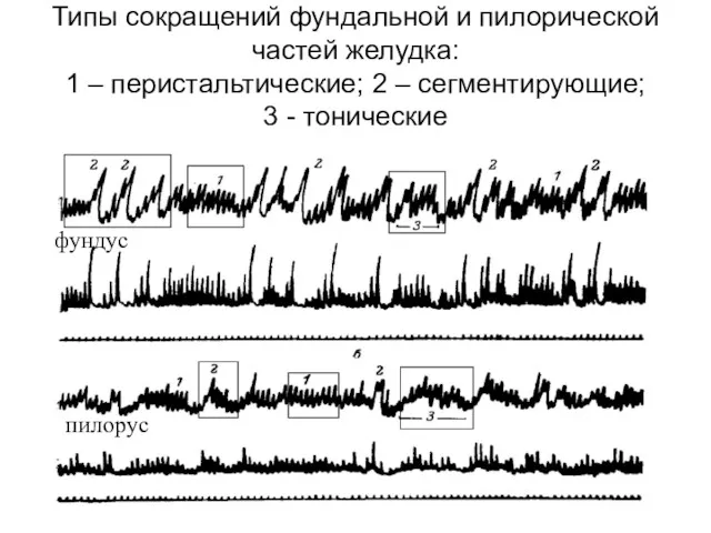 Типы сокращений фундальной и пилорической частей желудка: 1 – перистальтические;