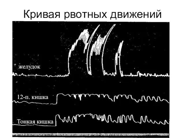 Кривая рвотных движений желудок 12-п. кишка Тонкая кишка