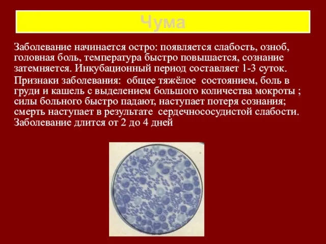 Чума Заболевание начинается остро: появляется слабость, озноб, головная боль, температура