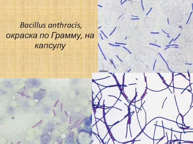 Bacillus anthracis, окраска по Грамму, на капсулу