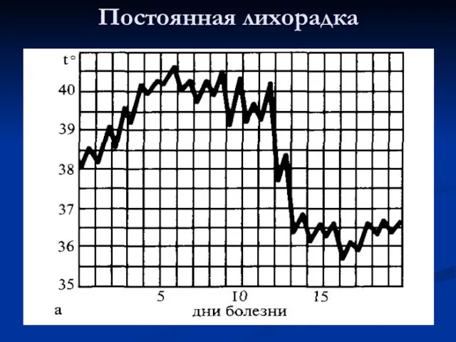 Постоянная лихорадка