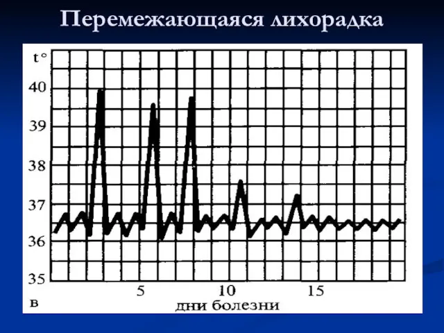 Перемежающаяся лихорадка