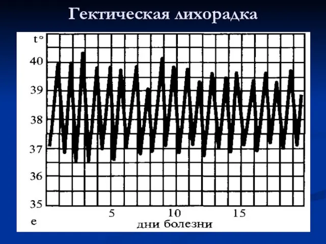 Гектическая лихорадка