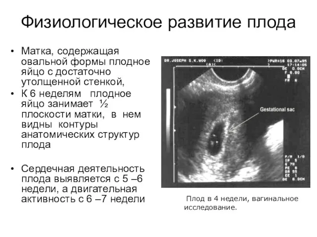 Физиологическое развитие плода Матка, содержащая овальной формы плодное яйцо с