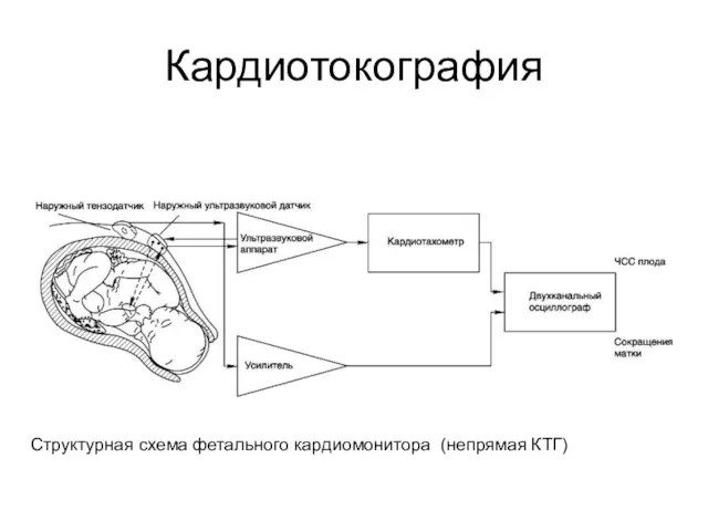 Кардиотокография Структурная схема фетального кардиомонитора (непрямая КТГ)