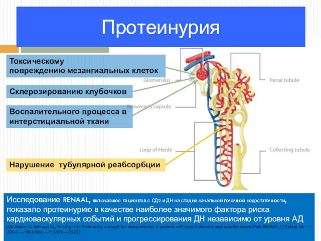 Протеинурия Токсическому повреждению мезангиальных клеток Склерозированию клубочков Воспалительного процесса в