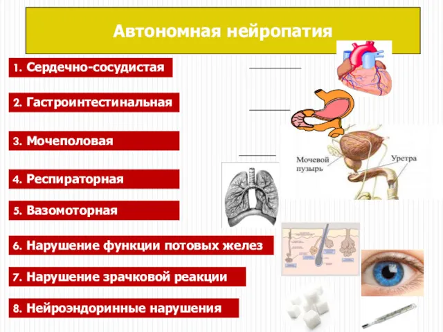 Автономная нейропатия 1. Сердечно-сосудистая 2. Гастроинтестинальная 3. Мочеполовая 4. Респираторная