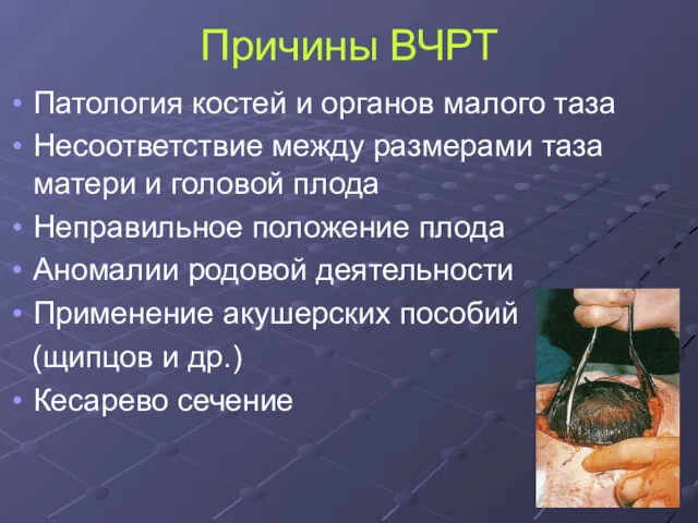 Причины ВЧРТ Патология костей и органов малого таза Несоответствие между