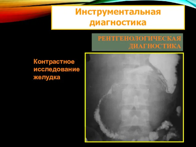 Инструментальная диагностика РЕНТГЕНОЛОГИЧЕСКАЯ ДИАГНОСТИКА Контрастное исследование желудка