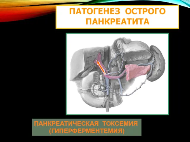 ПАТОГЕНЕЗ ОСТРОГО ПАНКРЕАТИТА ПАНКРЕАТИЧЕСКАЯ ТОКСЕМИЯ (ГИПЕРФЕРМЕНТЕМИЯ)